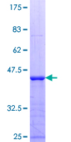 12.5% SDS-PAGE Stained with Coomassie Blue.